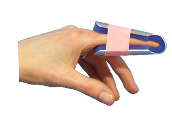 STECCA PER FRATTURA DITA A CAMPANA FARMASPLINT MISURA GRANDE PREFORMATA IN ALLUMINIO MODELLABILE CON IMBOTTITURA IN SPUGNA POLIURETANICA ANTIALLERGICA RADIOTRASPARENTE 15 CM - goldeneffe.it
