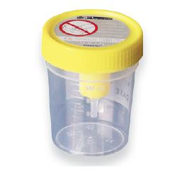 CONTENITORE URINA STERILE MEDIPRESTERIL CON SISTEMA TRANSFERT PER PROVETTE SOTTOVUOTO - goldeneffe.it